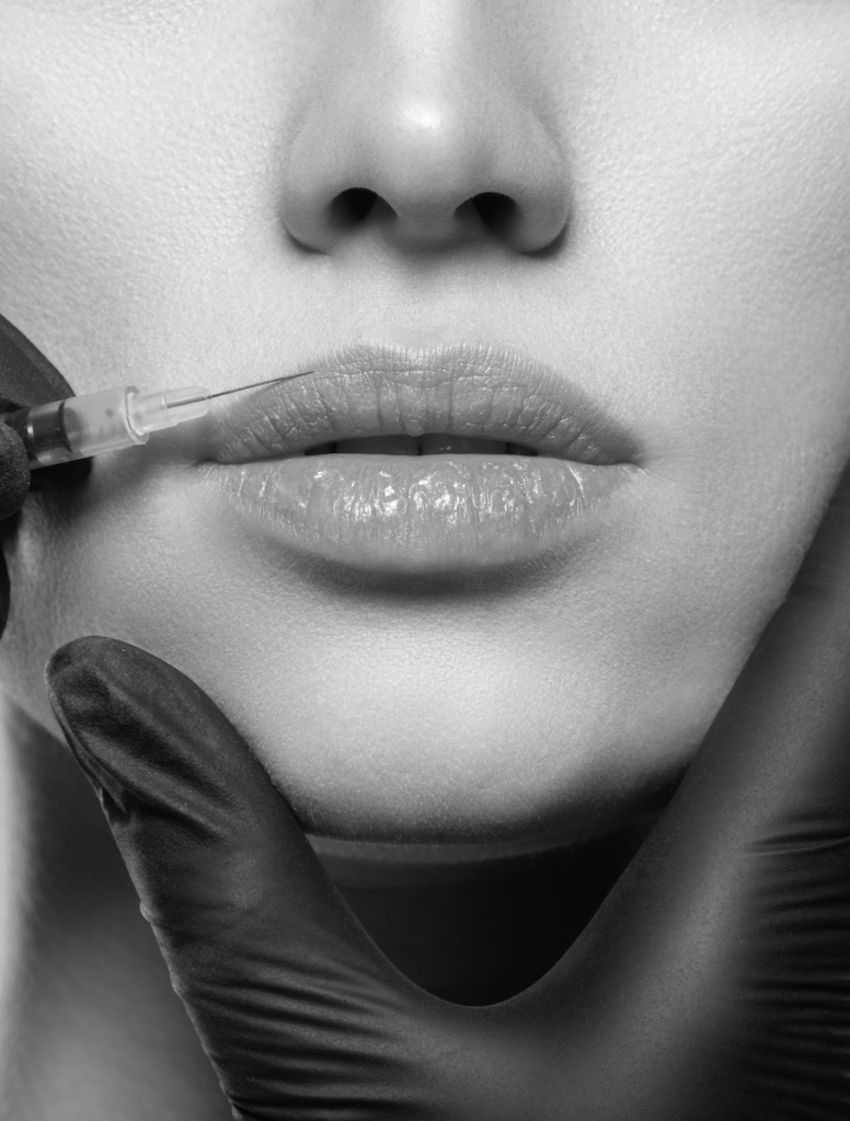 lip injection close-up in black and white for botox and dysport