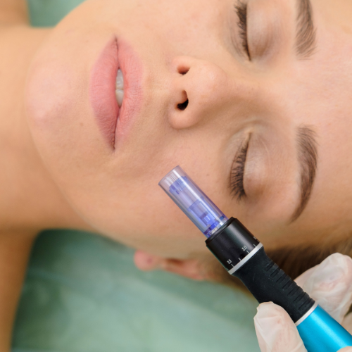 microneedling