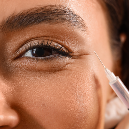 dermal fillers