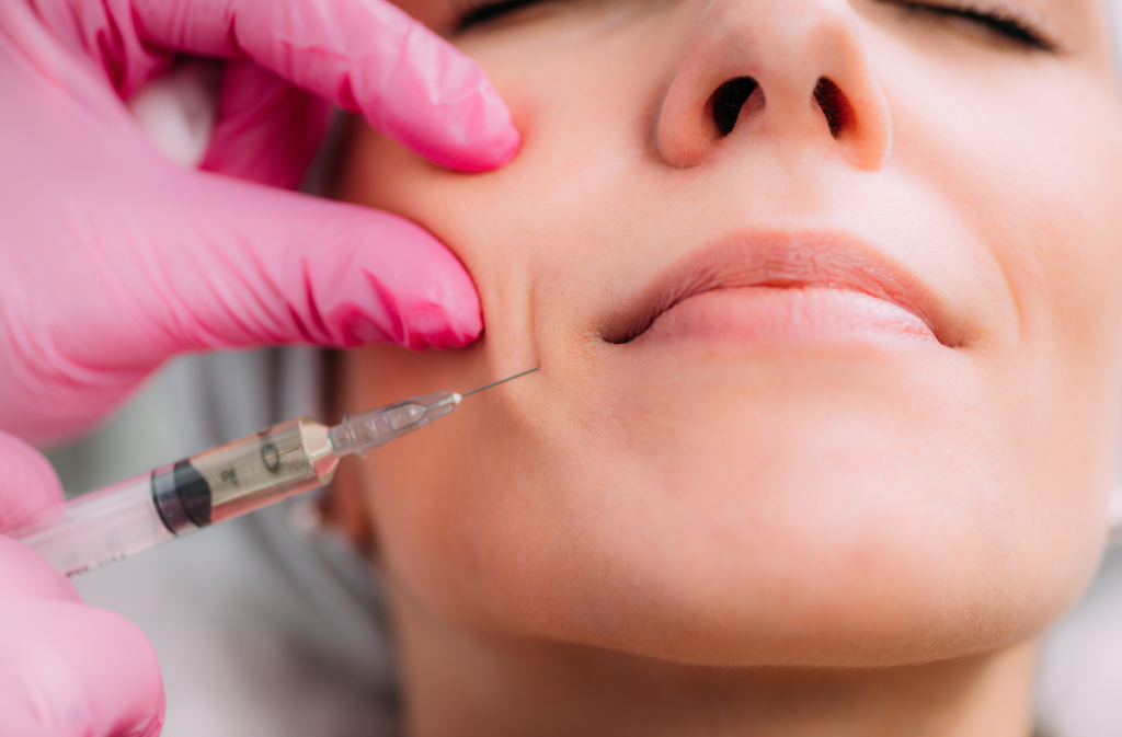 dermal fillers