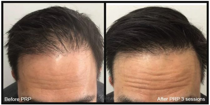 GamWellness - HairRestoration1