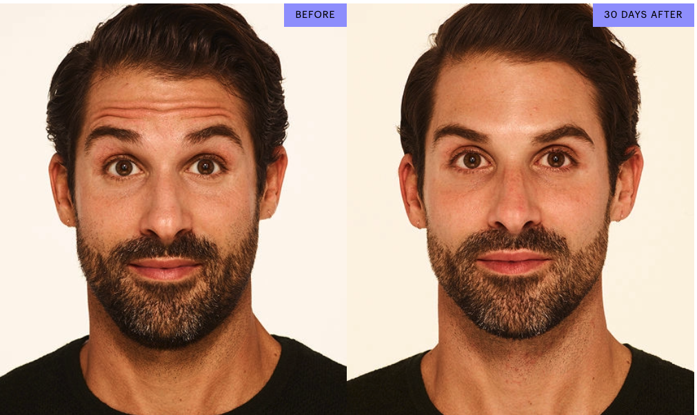 GamWellness - Neurotoxins1