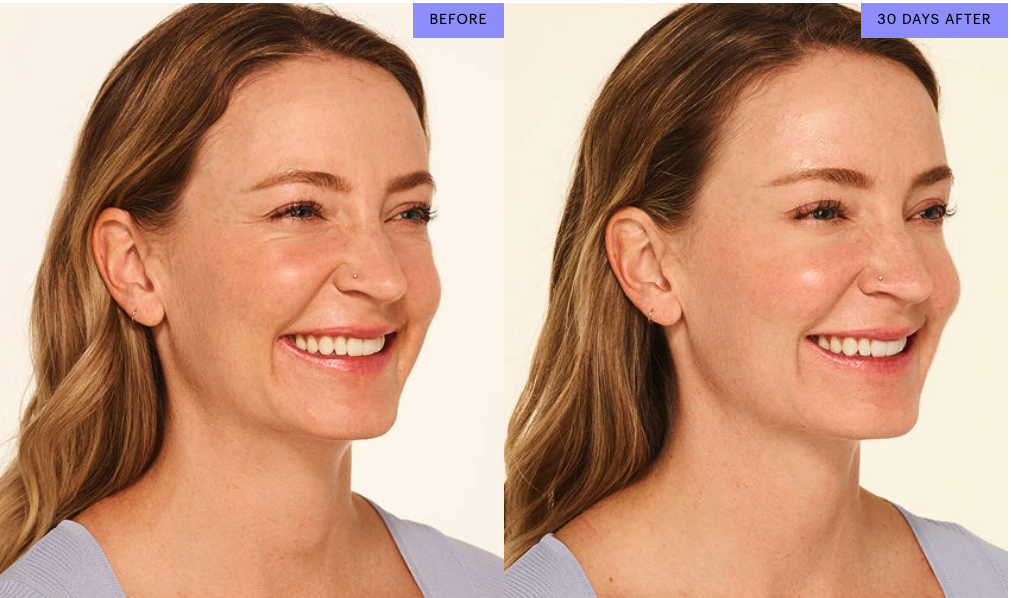 GamWellness - Neurotoxins2