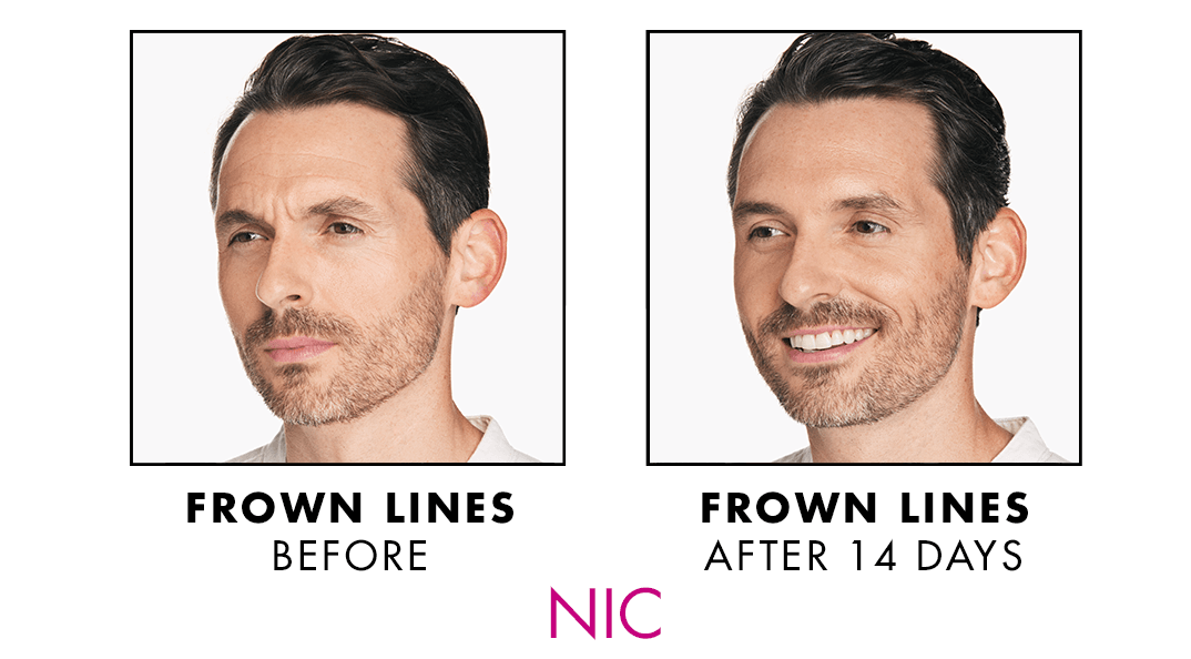 GamWellness - Neurotoxins3