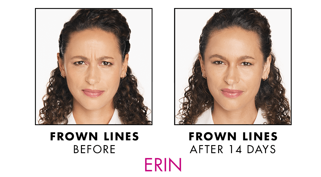 GamWellness - Neurotoxins4