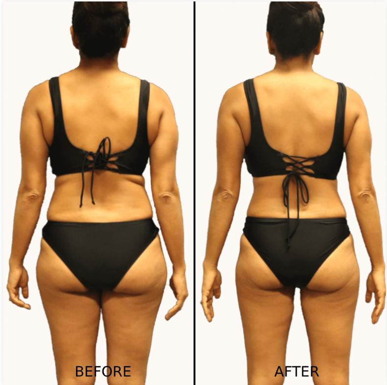 GamWellness - Semaglutide1